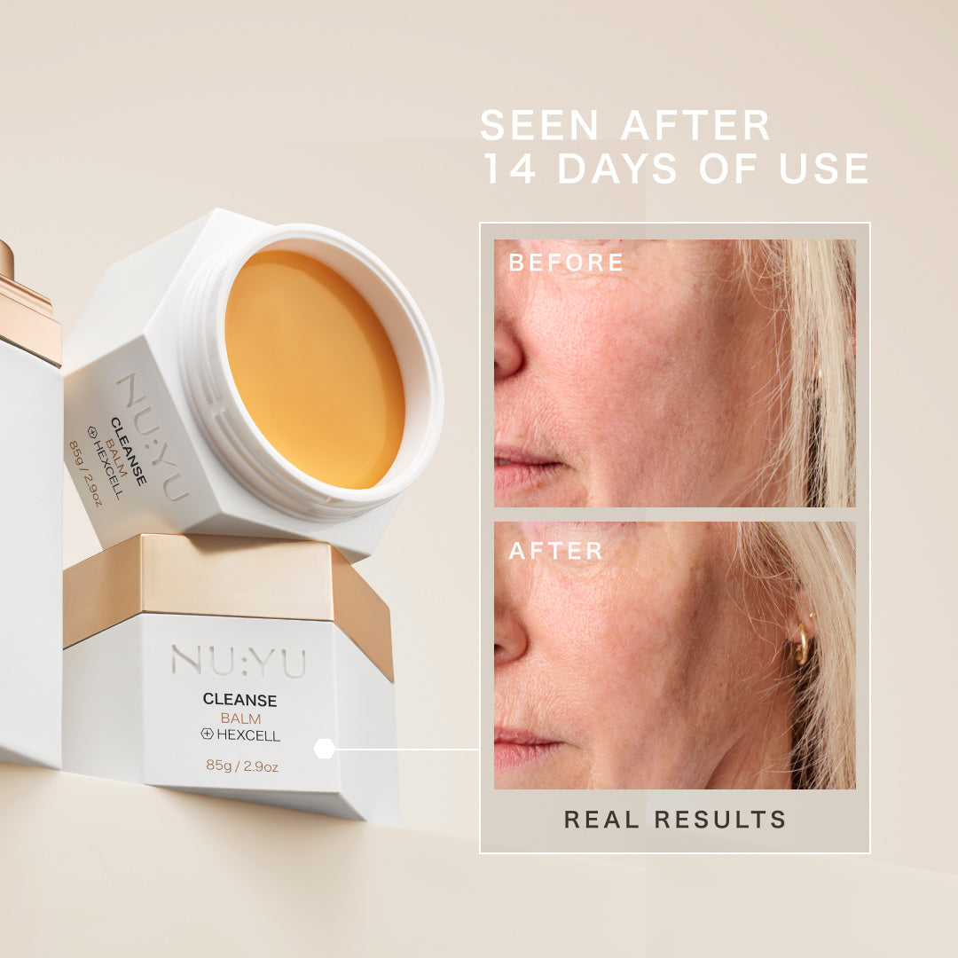 Cleanse Balm – NU:YU